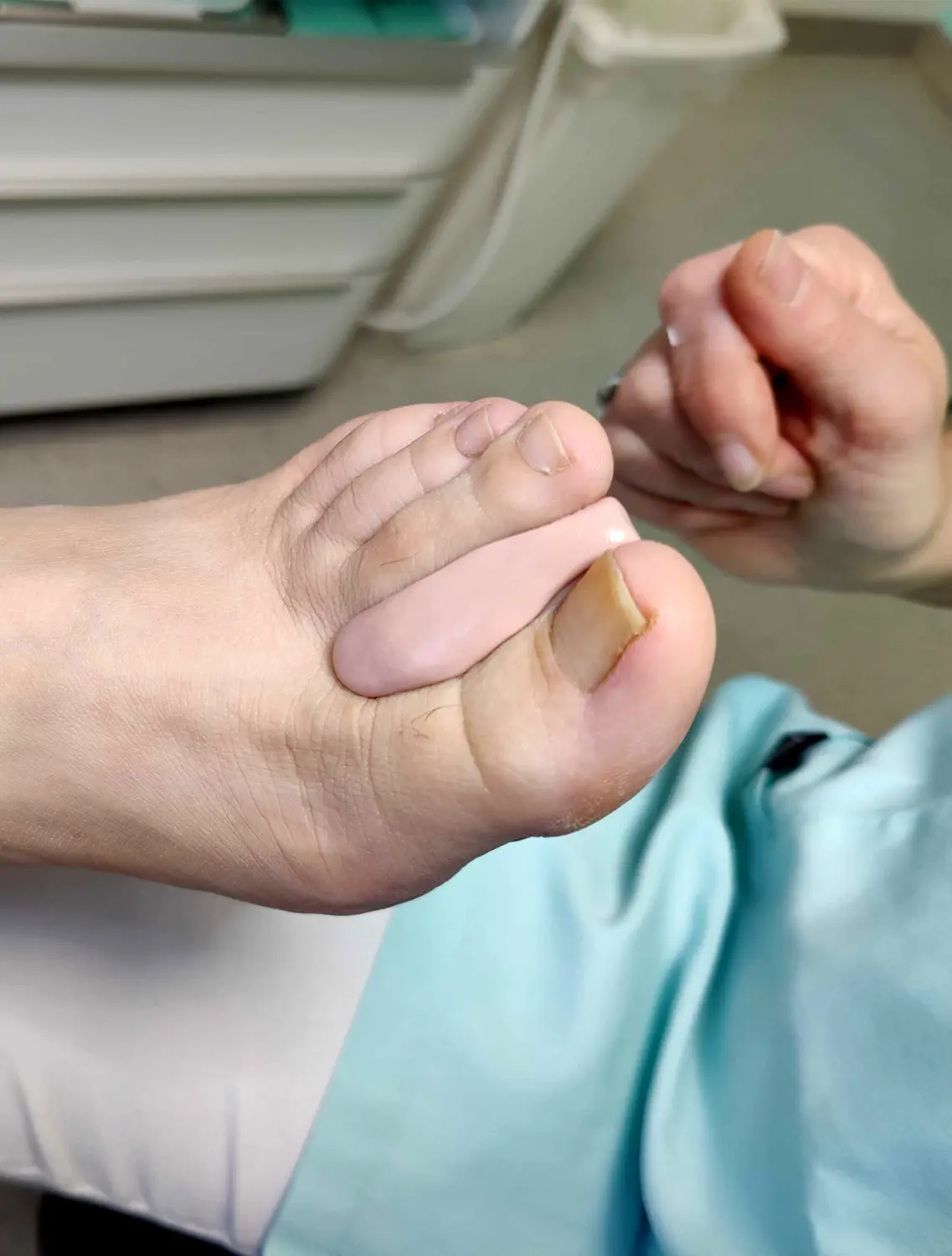 Fußpflege für Diabetespatienten von Podologie Elmshorn